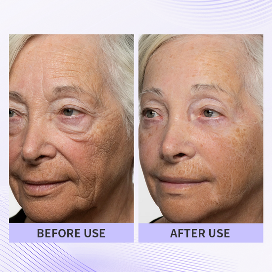 🏆🏆Last day - Purchase TLUPA® anti-aging eye cream and enjoy a 60% discount. It is non-irritating when used and can be used throughout the day (quickly removes dark spots, reduces dark circles, and reduces eye bags)