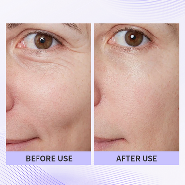 🏆🏆Last day - Purchase TLUPA® anti-aging eye cream and enjoy a 60% discount. It is non-irritating when used and can be used throughout the day (quickly removes dark spots, reduces dark circles, and reduces eye bags)