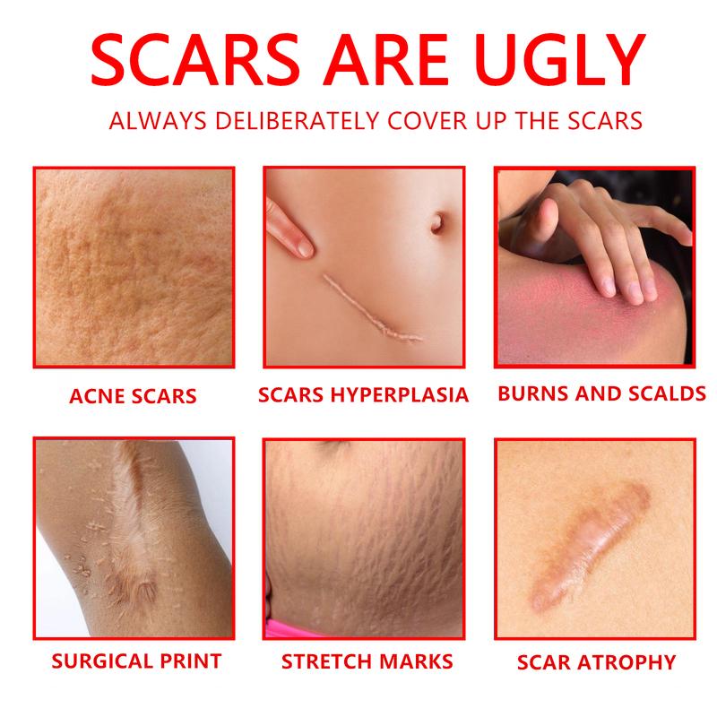 Final Hours—Sale Ending Soon!💥KAAR* Professional Scar Removal Gels | Gentle & Effective Daily Firming for All Skin Types