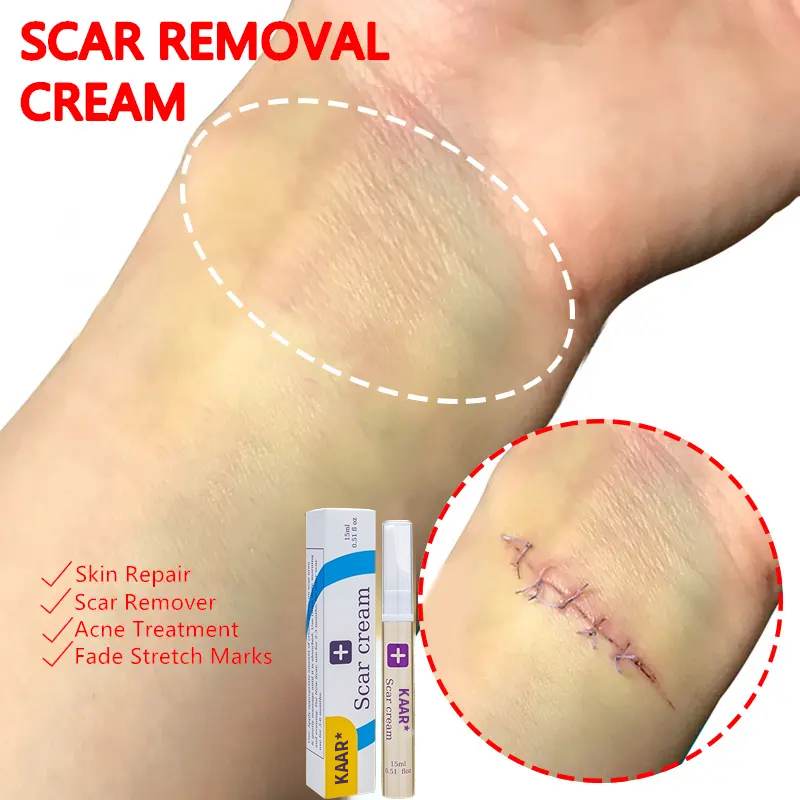 Final Hours—Sale Ending Soon!💥KAAR* Professional Scar Removal Gels | Gentle & Effective Daily Firming for All Skin Types