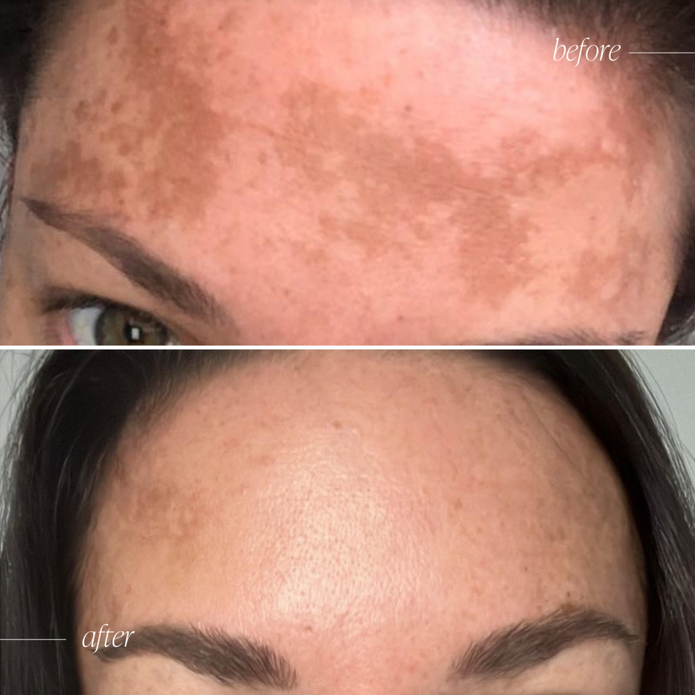⚡Luminous GleamAura Eye Cream: Quickly remove dark spots and firm the skin⚡