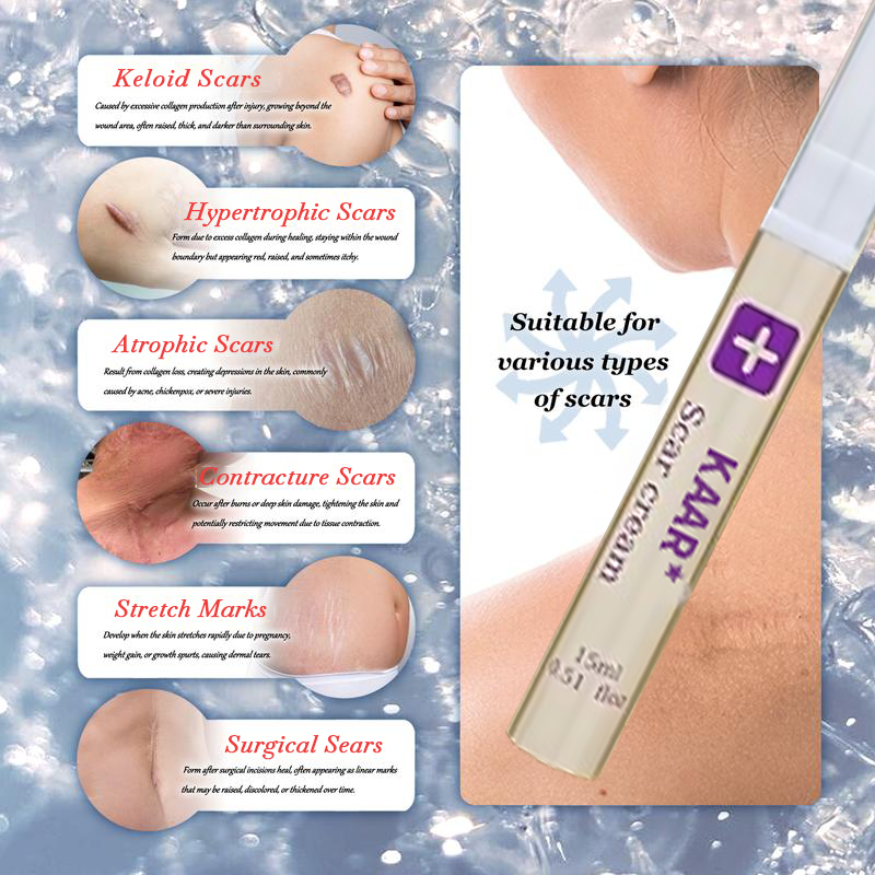 Final Hours—Sale Ending Soon!💥KAAR* Professional Scar Removal Gels | Gentle & Effective Daily Firming for All Skin Types