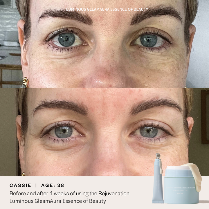 ⚡Luminous GleamAura Eye Cream: Quickly remove dark spots and firm the skin⚡