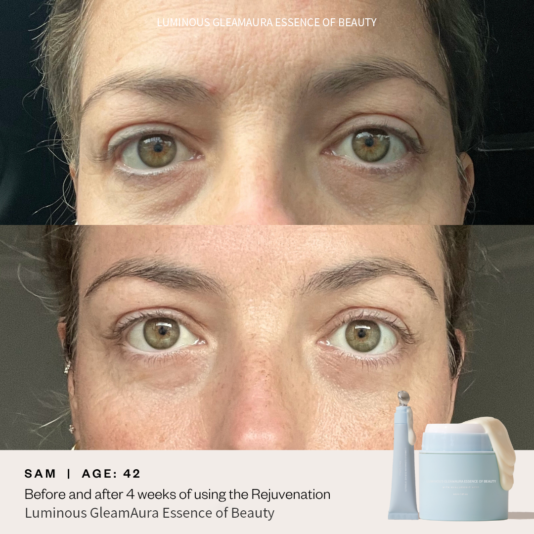 ⚡Luminous GleamAura Eye Cream: Quickly remove dark spots and firm the skin⚡