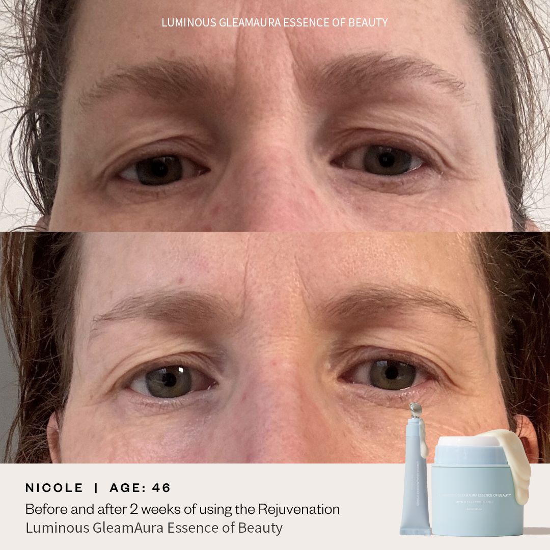 ⚡Luminous GleamAura Eye Cream: Quickly remove dark spots and firm the skin⚡