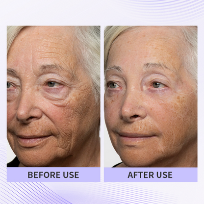🏆🏆Last day - Purchase TLUPA® anti-aging eye cream and enjoy a 60% discount. It is non-irritating when used and can be used throughout the day (quickly removes dark spots, reduces dark circles, and reduces eye bags)