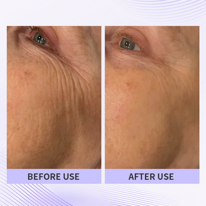 🏆🏆Last day - Purchase TLUPA® anti-aging eye cream and enjoy a 60% discount. It is non-irritating when used and can be used throughout the day (quickly removes dark spots, reduces dark circles, and reduces eye bags)