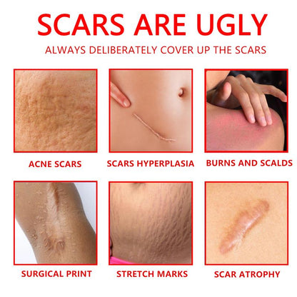Final Hours—Sale Ending Soon!💥KAAR* Professional Scar Removal Gels | Gentle & Effective Daily Firming for All Skin Types