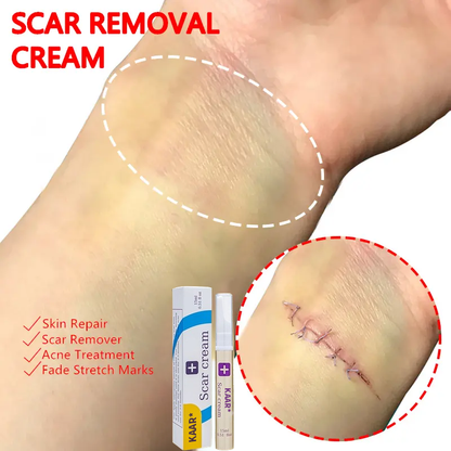 Final Hours—Sale Ending Soon!💥KAAR* Professional Scar Removal Gels | Gentle & Effective Daily Firming for All Skin Types